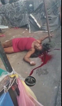 Woman Shot By Hitmen