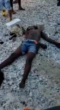 Half-Dead Man Cut Off Both Legs