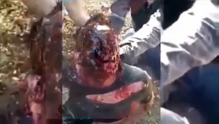 A Man Is Tortured By Burning His Face With Burning Alcohol
