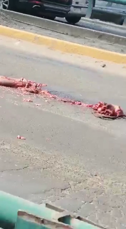 Man's Body Turned Into A Mutilated Piece Of Meat As A Result Of An Accident. Mexico
