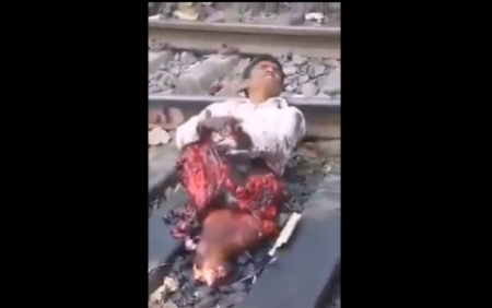 The Unfortunate Man Tries To Touch His Legs Cut Off By The Train