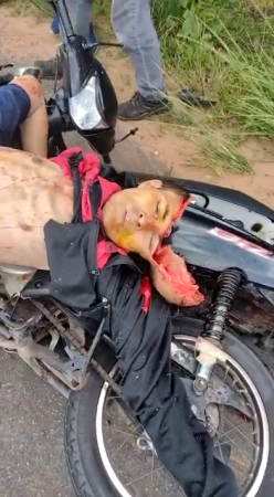 Dead And Brainless Motorcyclist