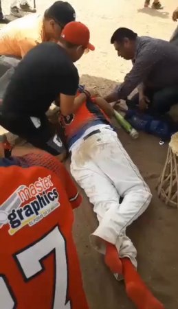 60 Year Old Man Dies While Playing Baseball. Mexico