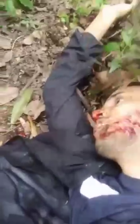 Killers Cut Out The Eye Of An Already Dead Man With A Knife