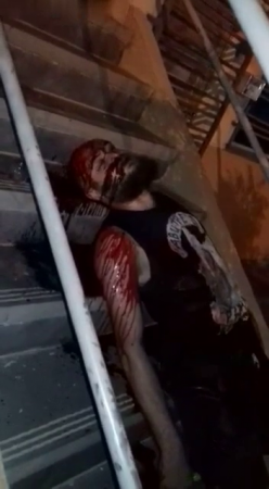 The Last Breaths Of A Bloodied Man Lying On The Stairs