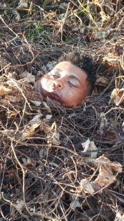 Motorcyclist's Head Is Lying In The Bushes After A Truck Accident