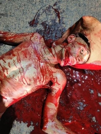 A Man Is Hacked To Death On The Street At Night. Brazil