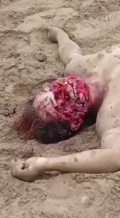 The Body Of A Man With A Eaten Face On The Beach