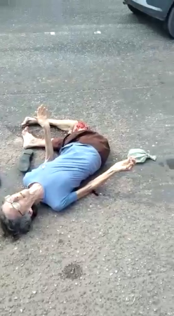 The Shapeless Body Of An Elderly Woman Hit By A Truck