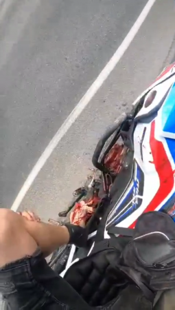 Motorcyclist Crushed His Leg While Overtaking A Truck