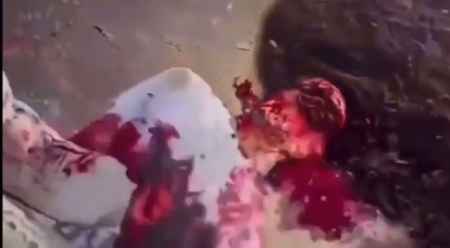 Cartel Members Cut All The Skin Off The Head And Opened The Chest From A Live, Bound Man