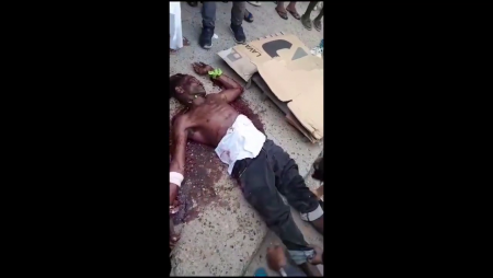 Dude On The Street Dies From Wounds Inflicted By A Machete