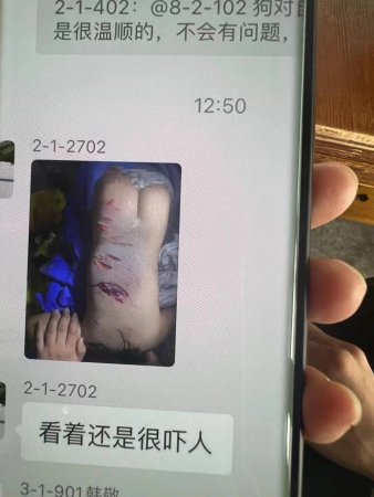 Child Warning! Dog Attacked A Child And His Mother. China