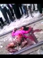 A Woman With Her Legs Cut Off Lies On The Railroad Tracks. India