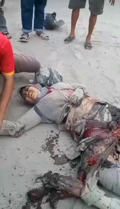 Maybe The Woman Will Have At Least One Leg Left » UncensoredVideo - Latest News Without Censorship
