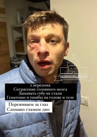 Harsh Detention Of A Bastard Who Had Previously Beaten A Man While Walking With His Wife. Russia