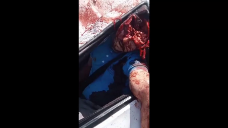 The Driver Of The Pickup Truck Remained In The Driver's Seat Thanks To The Seat Belt, But This Did Not Save His Skull