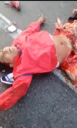 A Man On The Asphalt With Terrible Leg Wounds