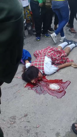 A Bus Drove Over A Young Woman's Head On A Bicycle. Aftermath
