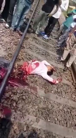 A Dude Cut In Half Lies On The Rails. Still Alive