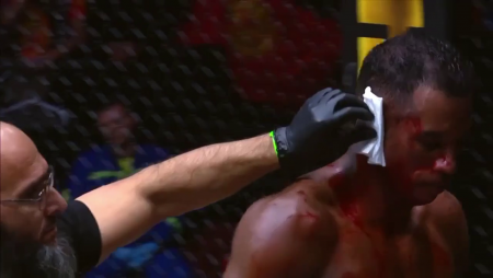 An Opponent's Blow During A Fight Tore Off The Ear Of An MMA Fighter