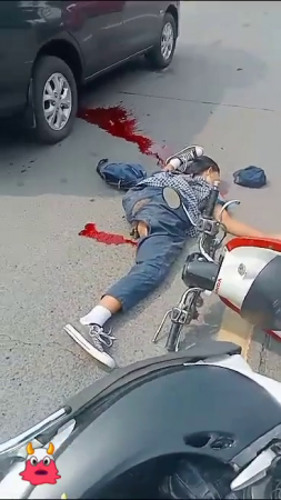 Dead Woman On A Scooter