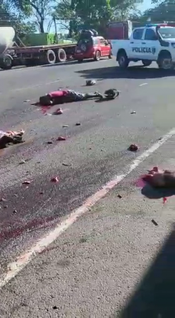 As A Result Of A Terrible Accident, Severed Body Parts Are Scattered Along The Road