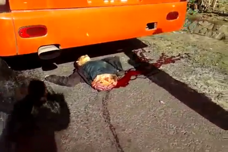After A Collision With A Bus, A Dude Splits In Two