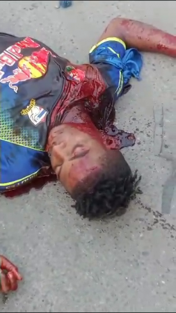 A Guy With A Punctured Artery Dies On The Asphalt In Front Of A Crowd Of Onlookers