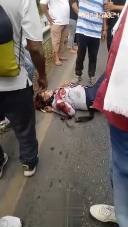 Accident Victim With Broken Arms Dies In Agony Lying On The Road