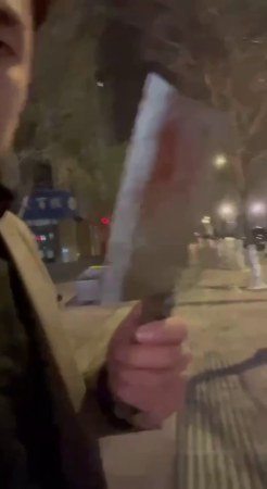Dude Shows Off The Ax He Used To Cut Off His Girlfriend's Hand