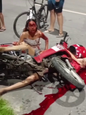 A Bloodied Woman In A State Of Shock After An Accident