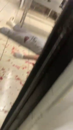 A Man Had His Head Chopped Off In The Kitchen Of A Restaurant. Aftermath