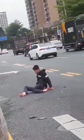 As A Result Of The Accident, The Dude's Left Leg Can Bend In Any Direction