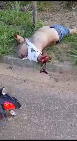 A Motorcyclist With Amputated Arms Died