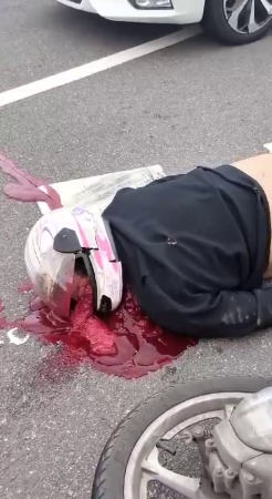 Despite Wearing A Helmet, The Motorcyclist's Skull Burst
