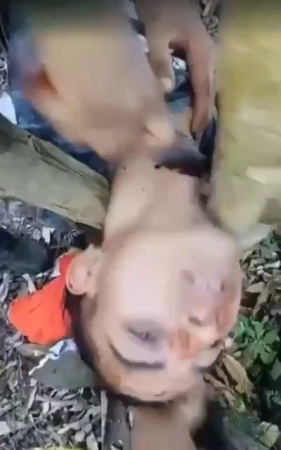 Cutting Off A Man's Head Clamped Between Tree Trunks