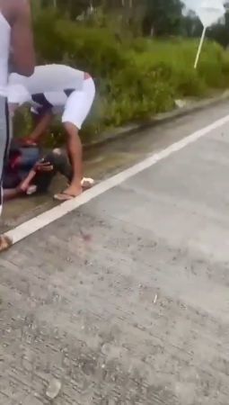 Dude Is Trying To Save A Woman's Almost Severed Leg