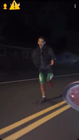 🦵Dude Lost His Leg On The Night Road