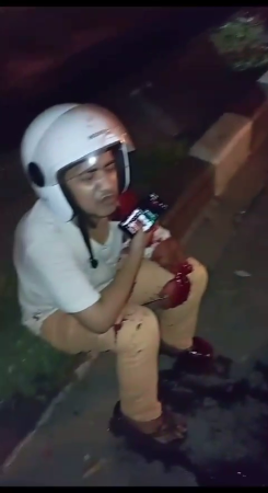 The Motorcyclist Looks Calm Despite The Loss Of His Hand