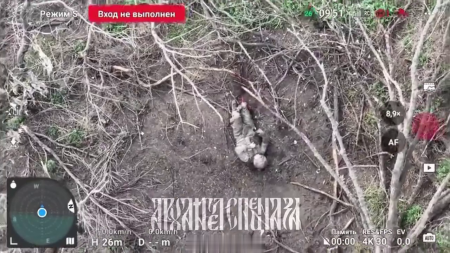 A Grenade Dropped From A Drone Tore Off The Defender Of Ukraine's Leg