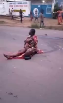 As A Result Of The Accident, A Man And A Woman Each Lost One Leg. Democratic Republic Of The Congo