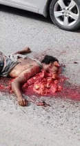 Dude Became A Bloody Mess After Falling Under A Truck