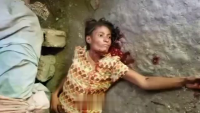 Woman With Her Throat Cut Calmly Slipping Away