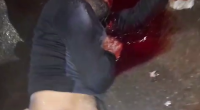 The Last Seconds Of A Man's Life Lying In A Pool Of Blood