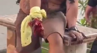 Bomb Exploded In His Hand