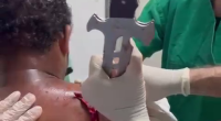 The Guy With The Sword In His Shoulder