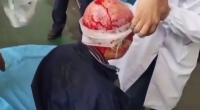 Woman Got Scalped At Factory