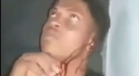 Dude Eats His Severed Ear