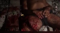 Dude Lost His Legs Under A Train
